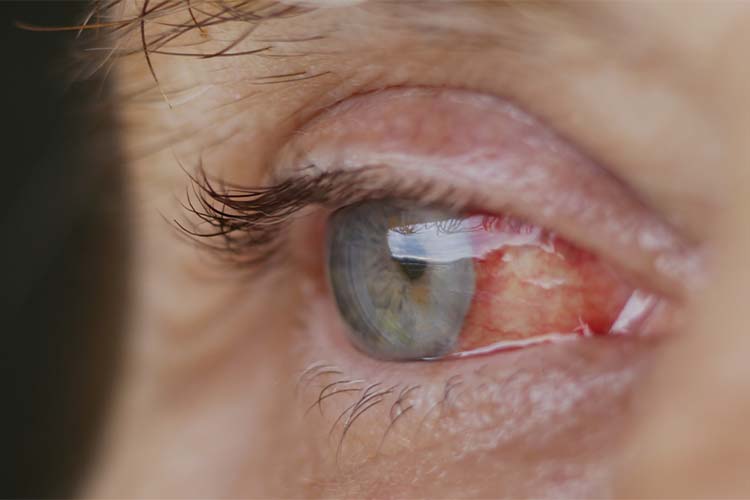 Emergency Care Image